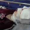 10 فوتی و ۳۷ مورد قطع عضو بر اثر حوادث چهارشنبه سوری امسال
