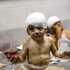 سازمان بهداشت جهانی: اوضاع در غزه فاجعه‌بار است