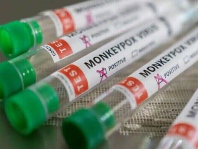 شناسایی ویروس آبله میمون پاکستان را به حالت آماده باش درآورد