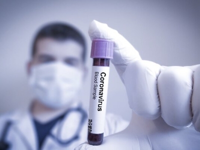 داروی ضد ویروس مؤثر در درمان کرونا در ایران تولید شد