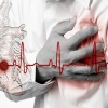 علائم حمله قلبی چیست؟