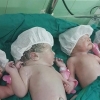 تولد نوزادان 4 قلو در مشهد/آستان قدس هزینه‌ها را متقبل شد