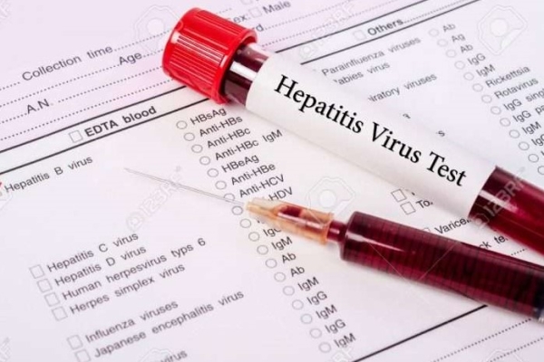 شناسایی ۷۲۷ بیمار مبتلا به هپاتیت در کشور 