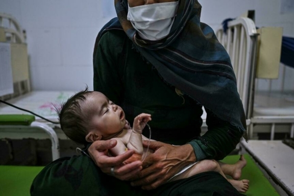 بیش از ۳ میلیون کودک افغان سوء تغذیه دارند