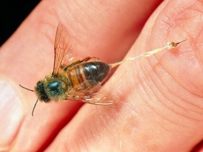 درمان سرطان سینه با کمک زهر زنبور عسل ظرف ۶۰ دقیقه