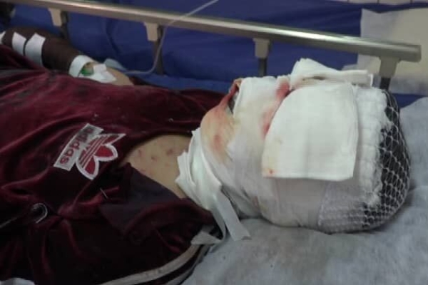 ۴۷ نفر از مصدومان حوادث چهارشنبه سوری قم در بیمارستان بستری شدند