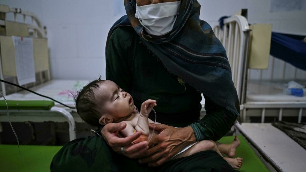 https://19dey.com/uploads/files/بیش-از-3-میلیون-کودک-افغان-سوءتغذیه-دارند.jpg